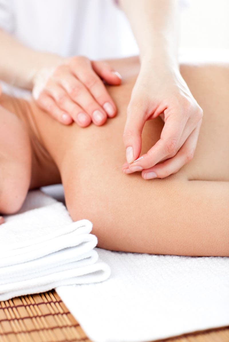 A close view of a gentle acupuncture treatment